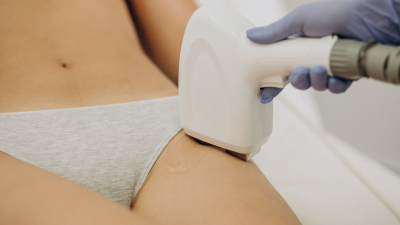 3 mituri despre epilarea definitivă – Ce e adevărat și ce nu?