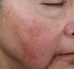 Ser antioxidant anti-imbatranire Obagi SUZANOBAGIMD™ Super Antioxidant Serum, 30 ml