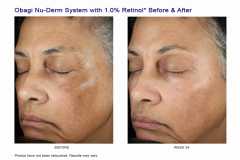 Sistem complet antiaging impotriva hiperpigmentarii Obagi Nu-Derm  Skin Transformation System - NORMAL TO DRY 7 Produse
