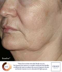 Tratament facial pentru fermitate Obagi ELASTIderm® Facial Serum, 30 ml