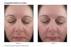 Crema hidratanta cu spectru larg SPF30 Obagi360® HydraFactor® Broad Spectrum SPF 30, 75 gr