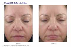 Crema hidratanta cu spectru larg SPF30 Obagi360® HydraFactor® Broad Spectrum SPF 30, 75 gr