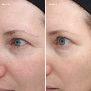 Tratament pentru ochi Colorescience Total Eye Firm & Repair Cream